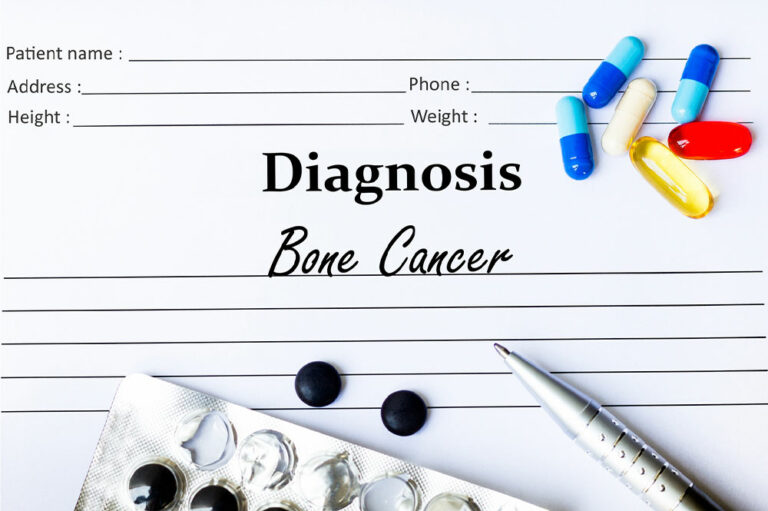Bone cancer – Types, warning signs, lifestyle tips, and more
