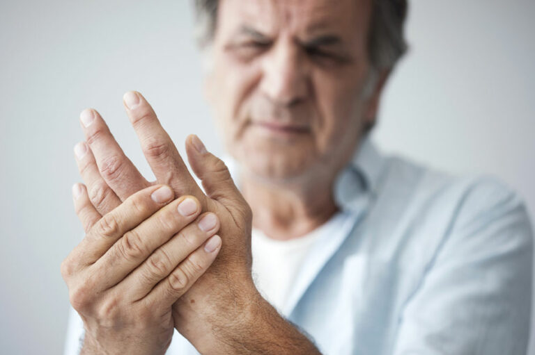 Everything to Know About Rheumatoid Arthritis