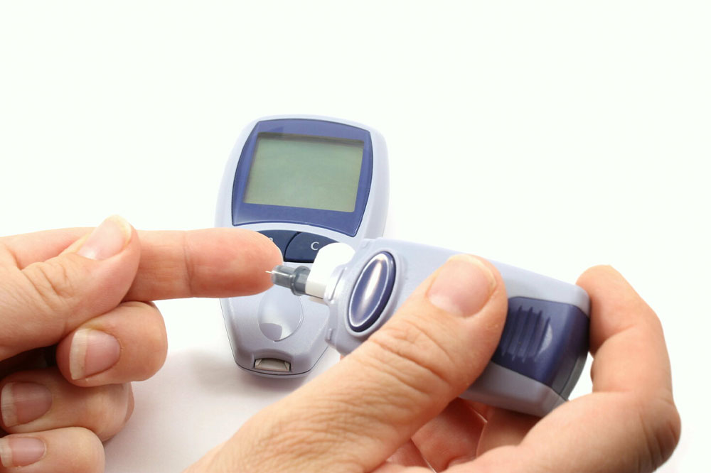 Hyperglycemia – Causes, symptoms, and management